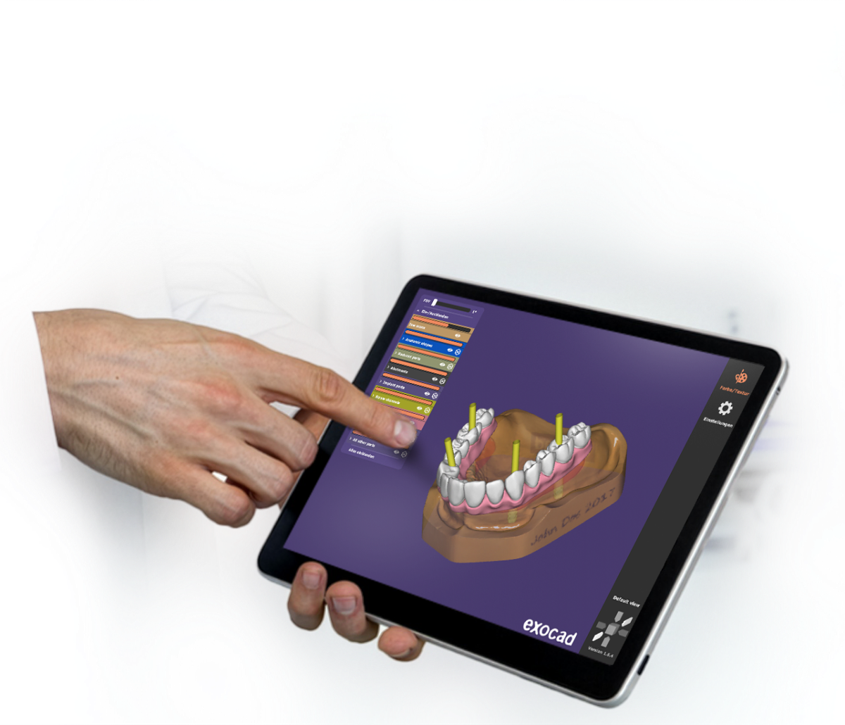 exocad webview – Exocad, CAD/CAM-Software