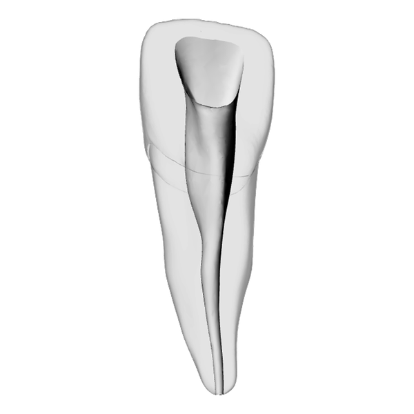 Incisor – Shaped canal, Clear