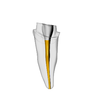 Incisor – Prepared crown, Gutta percha, Clear