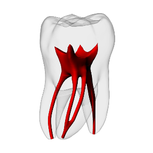 Molar – Merging MB2, Clear Root, White Crown, ~20#