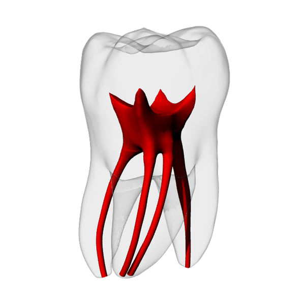 Molar – MB2, Radiopaque (White)