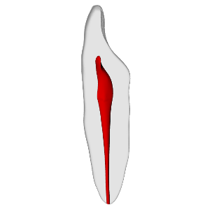 Incisor – Basic, Clear Root, White Crown, ~20#