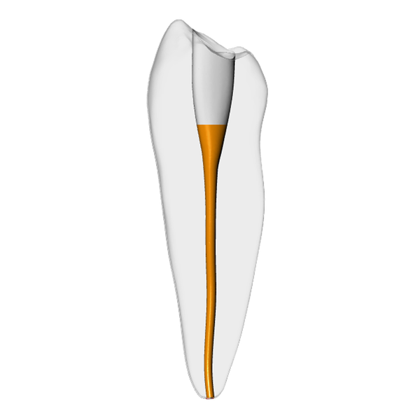 Premolar – Gutta percha, Clear