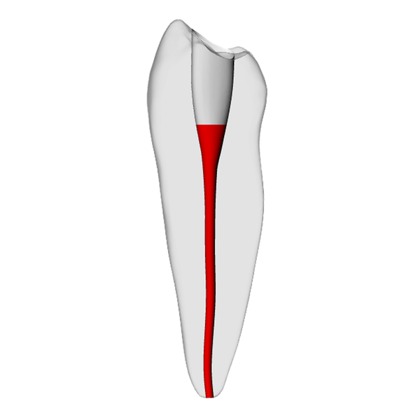 Premolar – Accessed, Conductive Canals, Clear
