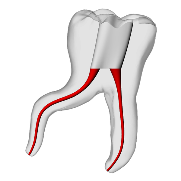 Molar – Severe Curvature 1, Clear