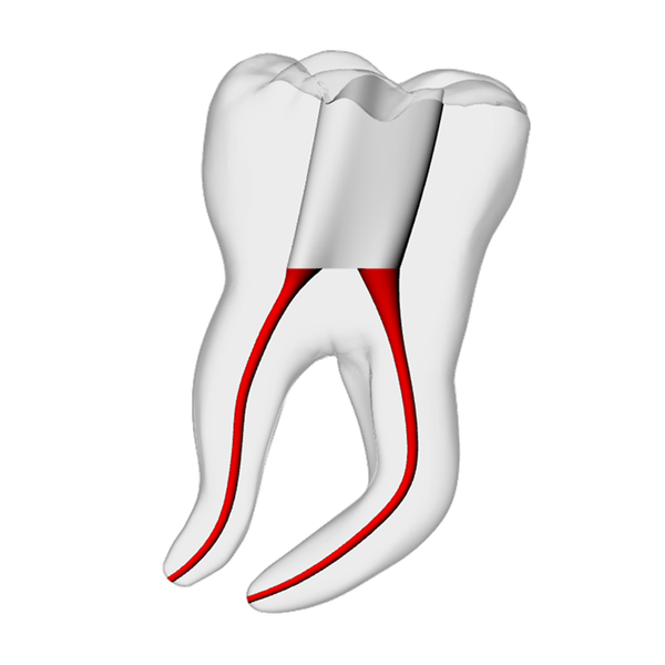 Molar – Severe Curvature 3, Clear