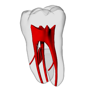 Molar – Accessory canals – DRSK Group AB, Demomodelle
