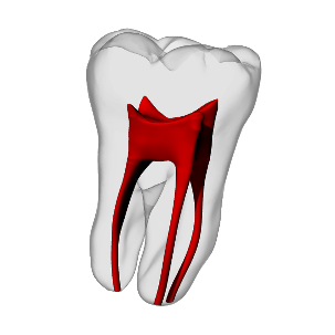 Molar – Basic, Clear Root, White Crown