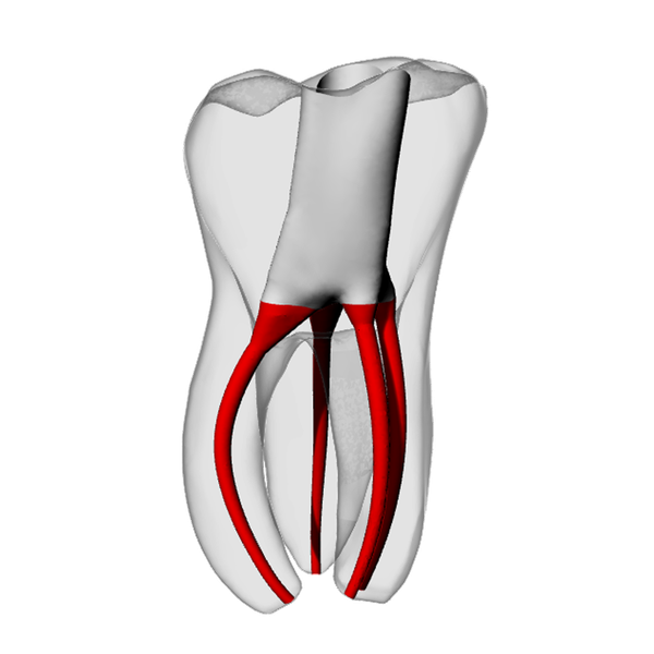 Molar – Accessed, MB2, Moderate Curvature
