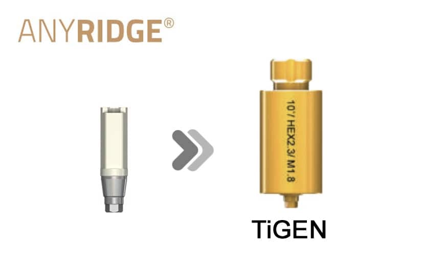 AnyRidge SHA(Without post) TiGEN(Pre-milled) – MegaGen F.D. GmbH, CAD/CAM-Software