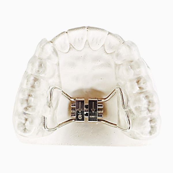 Bonded Rapid Palatal Expander EX/02