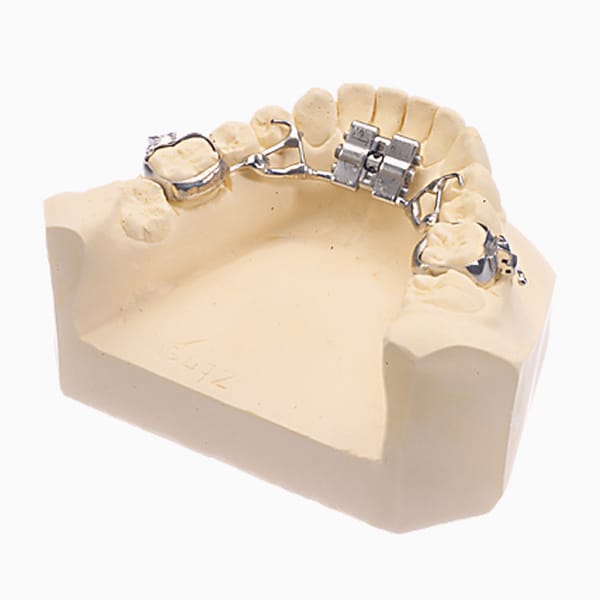 Fixed Transverse Expander EX/14