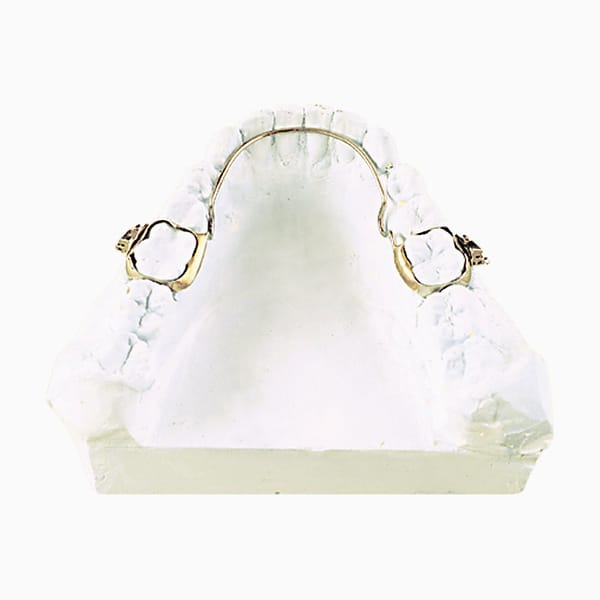 Lingual Arch HO/02