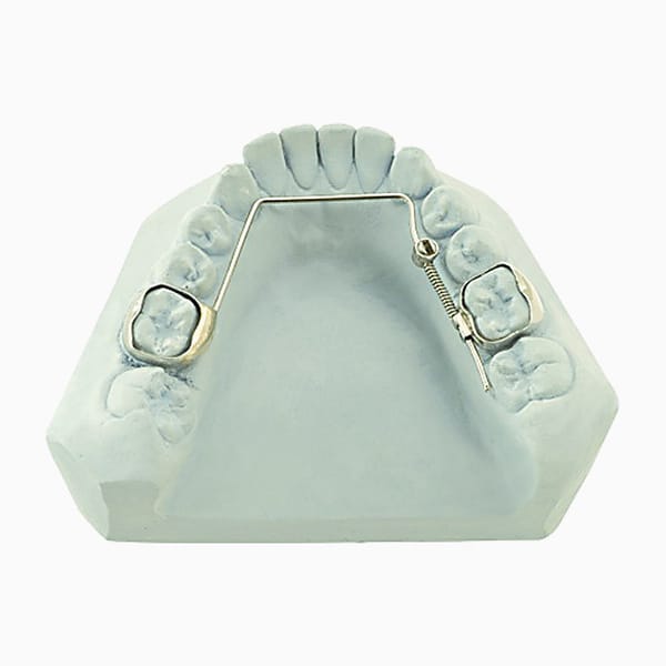Arch Expander MD/14