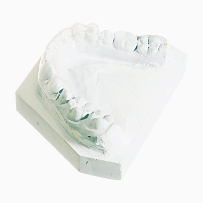 Bonded Retainer RA/11 – lab3d, Retention