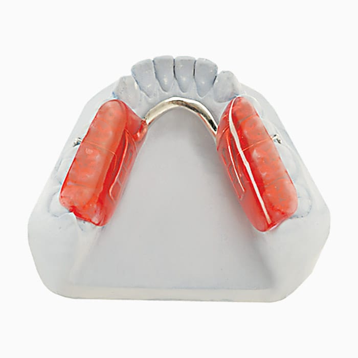 Gelb Splint SP/02 – lab3d, Knirscherschienen / CMD