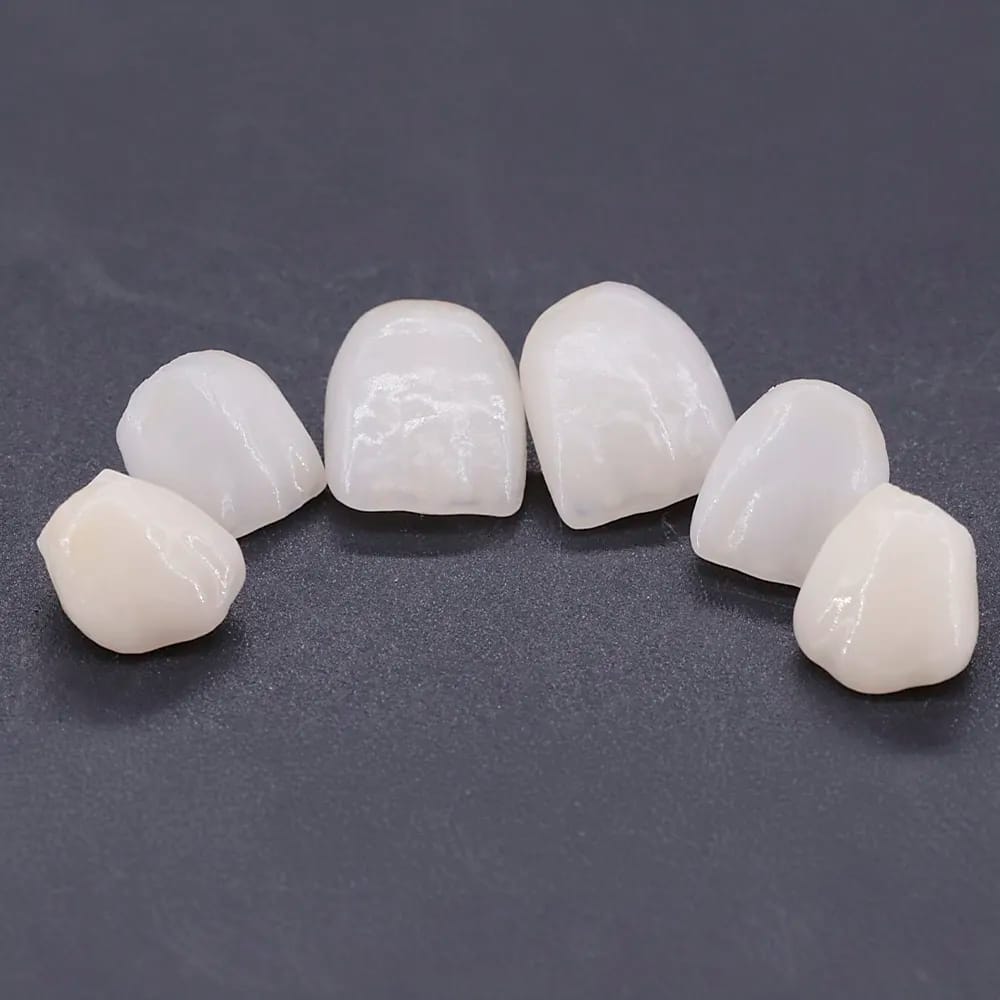 Cutback E-Max Krone – lab3d, Abutments