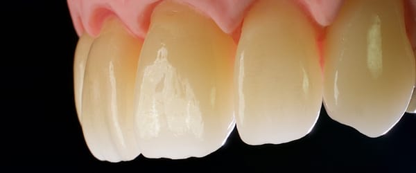 priti®multidisc ZrO2, Multi Translucent PLUS