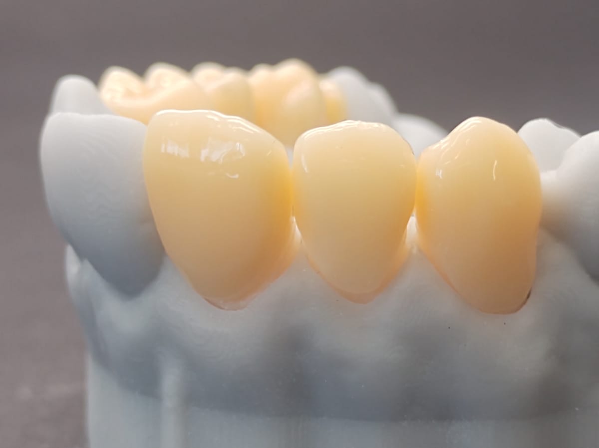 CORiTEC temp PMMA disc – Pritidenta GmbH, Ronden