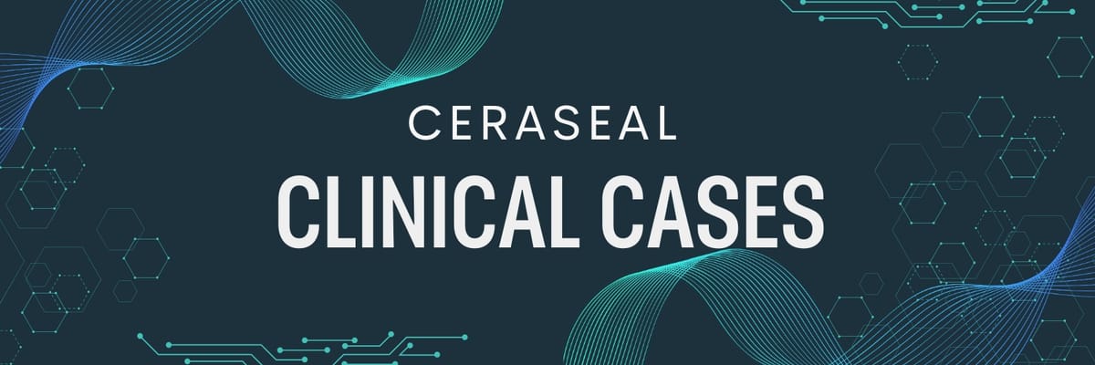 CeraSeal – META BIOMED CO., LTD., Zemente