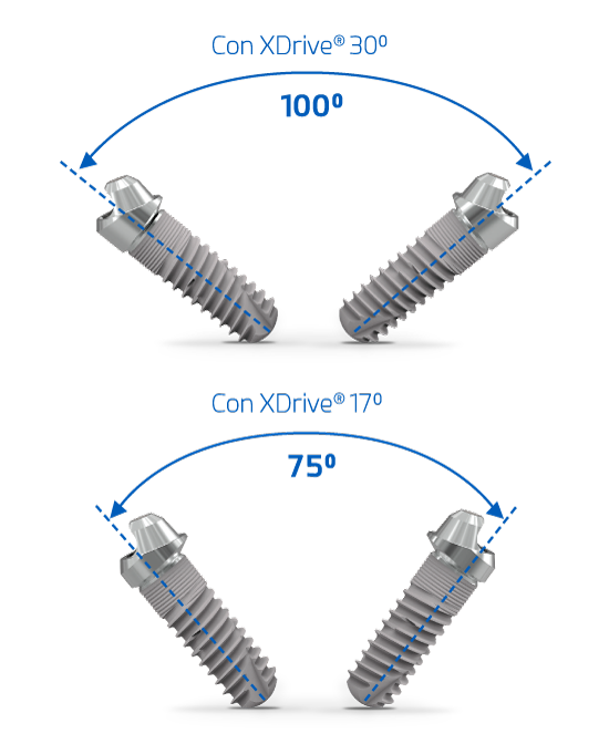 Sistema XDrive – Ziacom Medical S.L.U, Abutments